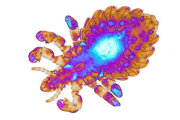 Phthiraptera_Pthiridae_Crab louse